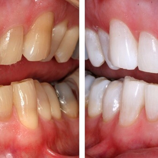 URBN Dental Implants & Invisalign | East River - Houston, TX