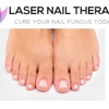 Laser Nail Therapy Clinic--Toenail Fungus Treatment Glendale gallery