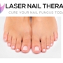 Laser Nail Therapy