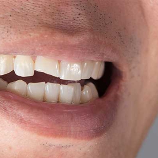 Ferrari Dental Care - Eltham, VIC