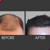 Maxim Hair Restoration gallery