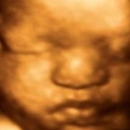 1st Glimpse Inc. 3D/4D Ultrasound - Medical Imaging Services