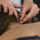 Laura A. Powers, L.Ac. - Acupuncture