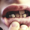 Zooka Super Toothcare For Kids gallery