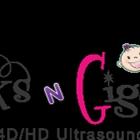 Kicks n Giggles 4D/HD Ultrasound