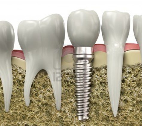 Wodonga Family Dental - Wodonga, VIC