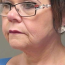 Dakota Plastic Surgery - Skin Care