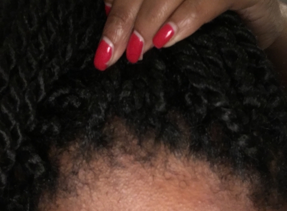 Kadi Professional Hair Braiding - Columbus, OH. This is to show what my edges normally look like