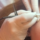 Electrolysis By Myrtle - Electrolysis