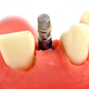 SEDA Dental of Jupiter - Dentists