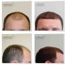 Natural Transplants Hair - Physicians & Surgeons, Surgery-General