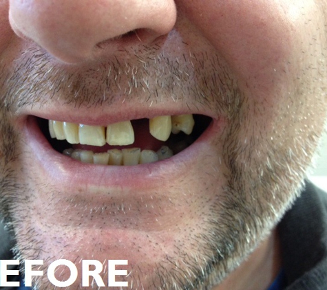 Warrawong Denture Clinic - Warrawong, NSW
