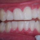 Chong, Carlos DDS - Teeth Whitening Products & Services