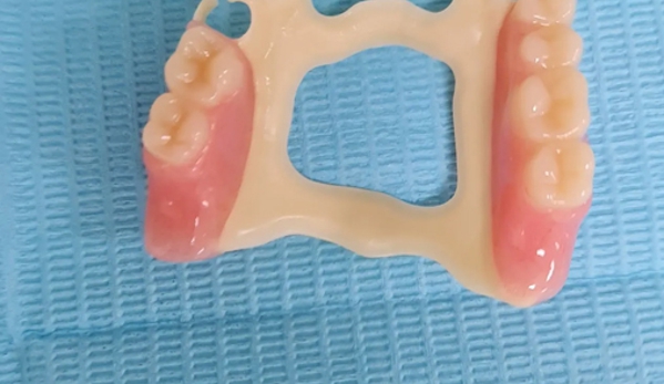 Right Dentures - Wanniassa, ACT