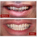 Candlewood Dental Care - Dental Hygienists