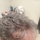 Hair Replacement Associates - Hair Replacement
