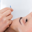 Joyce Towne Acupuncture Clinic - Acupuncture