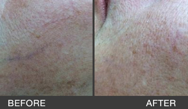 South Coast Skin & Vein Clinic - Wollongong, NSW