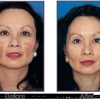 vivaMD Medical Spa & Weight Management gallery