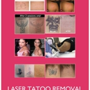 AAA Jewelry,ear piercing,laser tattoo removal... - Gold, Silver & Platinum Buyers & Dealers