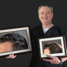 Arocha Hair Restoration