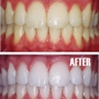 Diamond Dental & Orthodontics