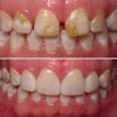 Dental Center At Zebulon - Dentists