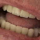 Affordable Dentures - Prosthodontists & Denture Centers