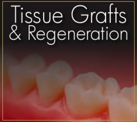 Gwinnett Dental Implant & Periodontal Center - Lilburn, GA