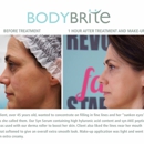 BodyBrite South County - Hair Removal