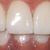 StarWhite Dental - Murrieta gallery