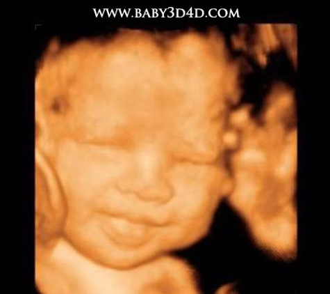 3D 4D Ultrasound by 4D Special Delivery - Upland, CA