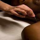 Dr Dale White Jr DC - Acupuncture