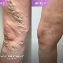 Vein Treatment Clinic | Huntington Beach - Medical Centers