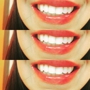 Radiant White Smiles of Austin Cosmetic Teeth Whitening