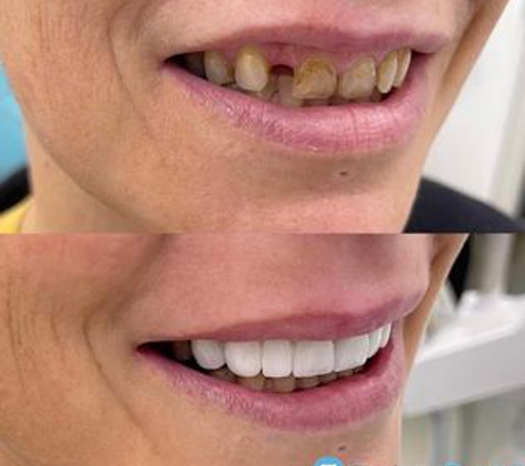 Geelong Dental Group - Belmont - Belmont, VIC. Geelong Dental Group smile make over