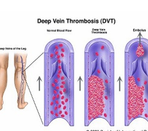 Lymphoedema Clinic Adelaide - Walkerville, SA