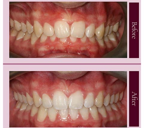 Capital Smiles Orthodontist - Deakin, ACT