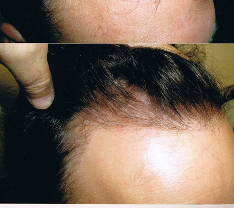 Tampa Bay Hair Restoration - Clearwater, FL