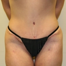 Plastic Surgery Specialists PC - Physicians & Surgeons, Plastic & Reconstructive