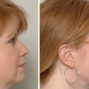 Romano, James J, MD - Physicians & Surgeons