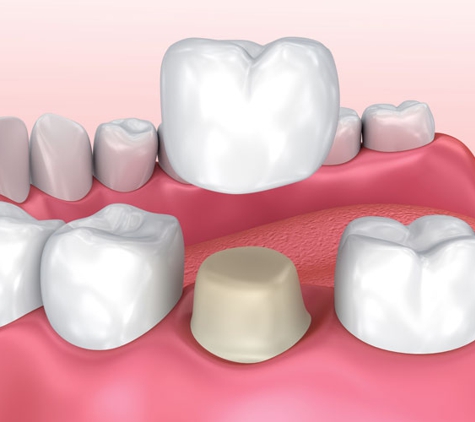 Gymea Dental