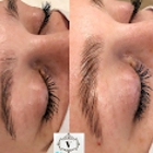 Venus Skincare Spa