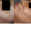 Park Slope Dermatology & Medi Spa, Brigitte A. Holder, M.D. gallery