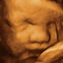 TLC Imaging 3D/4D Ultrasounds - Medical Imaging Services