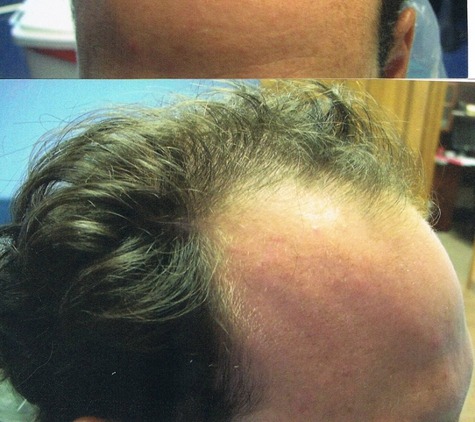 Tampa Bay Hair Restoration - Clearwater, FL