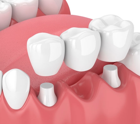 Gymea Dental