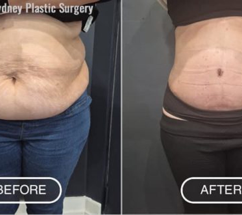 Sydney Plastic Surgery - Dr Barnouti - Parramatta, NSW