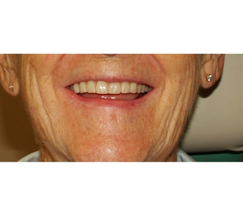 Mudgeeraba Denture Clinic - Mudgeeraba, QLD