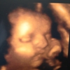 Moms-to-Be Ultrasound gallery